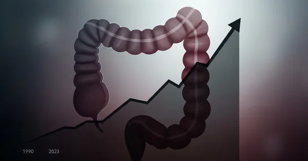 Illustration shows the colon alongside an upward trending graph from 1990 to 2023.